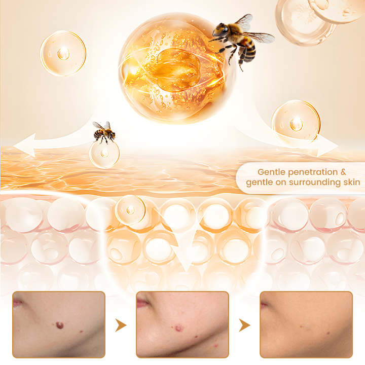 Biancat® BeeVenom Wart Drop Serum