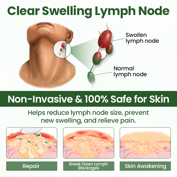 Timilk® BodyRelief Circulation Cream