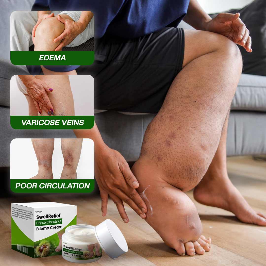 Timilk® SwellRelief Horse Chestnut Edema Cream