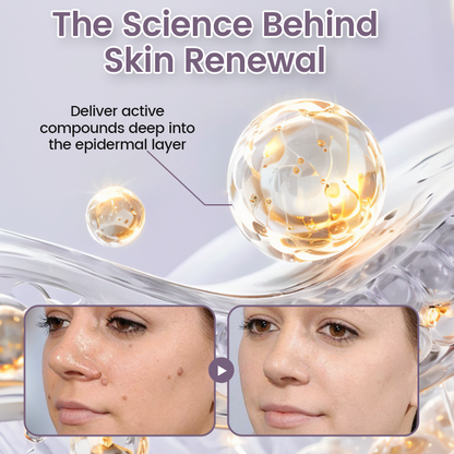 Ceoerty® WartSmooth Renewal Serum